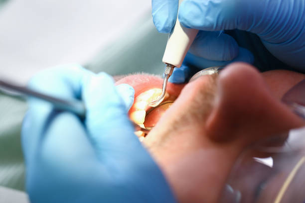 Best Emergency Treatment for Oral Infections in Perry, FL
